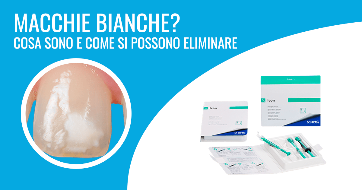 Macchie Bianche sui Denti